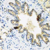 Anti-Defensin beta 4B antibody used in IHC (Paraffin sections) (IHC-P). GTX66832