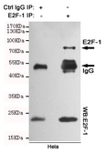 Anti-E2F1 antibody [4G8] used in Immunoprecipitation (IP). GTX66839