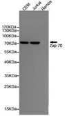 Anti-ZAP70 antibody [4B2] used in Western Blot (WB). GTX66846