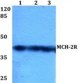 Anti-MCHR2 antibody used in Western Blot (WB). GTX66851