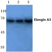 Anti-ELOA3 antibody used in Western Blot (WB). GTX66855