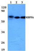 Anti-NBPF6 antibody used in Western Blot (WB). GTX66863