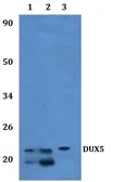 Anti-DUX5 antibody used in Western Blot (WB). GTX66865