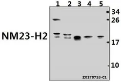 Anti-nm23-H2 antibody used in Western Blot (WB). GTX66869