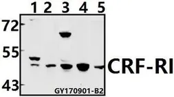 Anti-CRHR1 + CRHR2 antibody used in Western Blot (WB). GTX66871