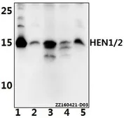 Anti-NHLH1 + NHLH2 antibody used in Western Blot (WB). GTX66872