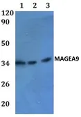 Anti-MAGEA9 antibody used in Western Blot (WB). GTX66873
