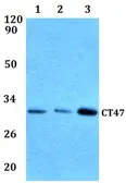 Anti-CT47 antibody used in Western Blot (WB). GTX66874