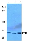 Anti-CT47 antibody used in Western Blot (WB). GTX66875
