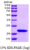 SlyD protein (active). GTX66883-pro