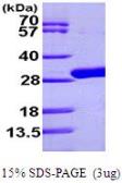 Uridine phosphorypase protein, His tag (active). GTX66887-pro