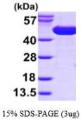 SurA protein, His tag (active). GTX66888-pro