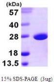 SodA protein, His tag (active). GTX66889-pro