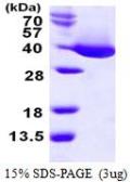 Malate dehydrogenase protein, His tag (active). GTX66891-pro