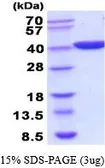 Idha protein, His tag (active). GTX66894-pro