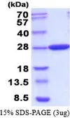 Carbonic anhydrase protein, His tag (active). GTX66896-pro