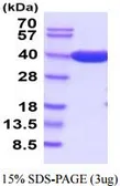 AmpC protein, His tag (active). GTX66897-pro