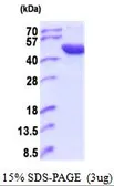 Human ACP6 protein, His tag (active). GTX66901-pro