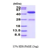 Human Adenosine Deaminase protein, His tag (active). GTX66902-pro