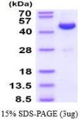 Human Adenosine kinase protein, His tag (active). GTX66903-pro