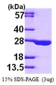 Human Adenylate kinase 1 protein, His tag (active). GTX66905-pro