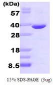 Human AKR1B1 protein (active). GTX66910-pro