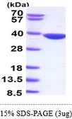 Human AKR1B10 protein (active). GTX66911-pro