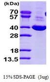 Human AKR1C1 protein, His tag (active). GTX66912-pro