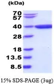 Human AKR1C1 protein (active). GTX66913-pro