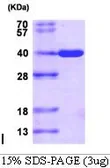 Human AKR1C3 protein, His tag (active). GTX66914-pro