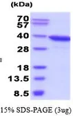 Human AKR1C3 protein (active). GTX66915-pro