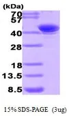 Human AKR7A2 protein, His tag (active). GTX66916-pro