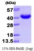 Human AKR7A3 protein, His tag (active). GTX66917-pro