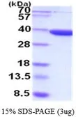 Human AKR7A3 protein (active). GTX66918-pro