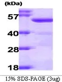 Human ALDH2 protein (active). GTX66919-pro