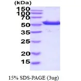Human ALDH3A1 protein, His tag (active). GTX66921-pro