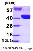Human Aldolase A protein, His tag (active). GTX66922-pro