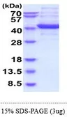 Human Aldolase C protein (active). GTX66923-pro