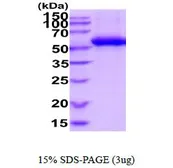 Human Antithrombin III protein, His tag (active). GTX66925-pro