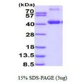Human Biglycan protein, His tag (active). GTX66929-pro