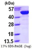 Human BLMH protein, His tag (active). GTX66930-pro