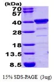 Human BLVRA protein (active). GTX66931-pro
