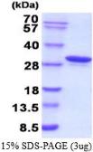 Human Carbonic Anhydrase 1 protein, His tag (active). GTX66934-pro