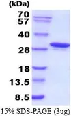 Human Carbonic Anhydrase 1 protein, His tag (active). GTX66934-pro