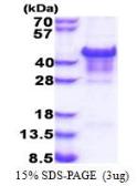 Human Carbonic Anhydrase 14 protein, His tag (active). GTX66935-pro
