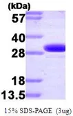 Human Carbonic Anhydrase II protein (active). GTX66936-pro