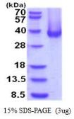 Human Carbonic Anhydrase XII protein, His tag (active). GTX66937-pro