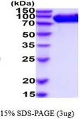 Human CD26 protein, His tag (active). GTX66941-pro
