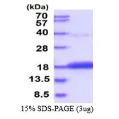Human CDA protein, His tag (active). GTX66943-pro