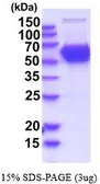 Human CNDP1 protein, His tag (active). GTX66946-pro
